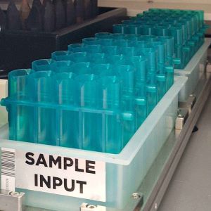 DNA Extraction Services (blood or sputum)